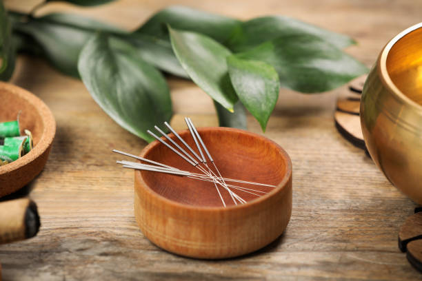 Cuenco con agujas de acupuntura estériles listas para una sesión de Medicina Tradicional China
